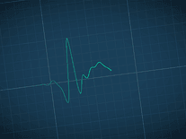 Small screenshot 1 of zz Heart Monitor 2