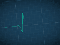Small screenshot 3 of zz Heart Monitor 2