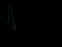Screenshot of zz Heart Monitor
